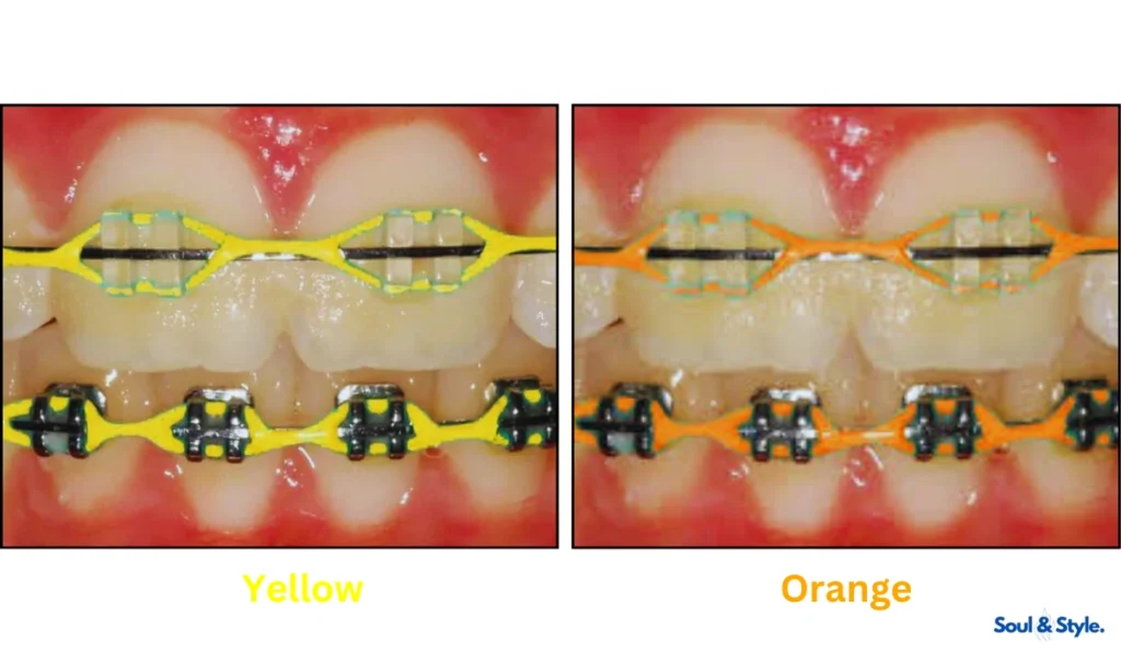 yellow and orange braces
