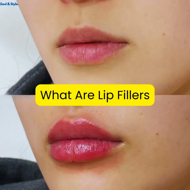 How Much Is Lip Filler