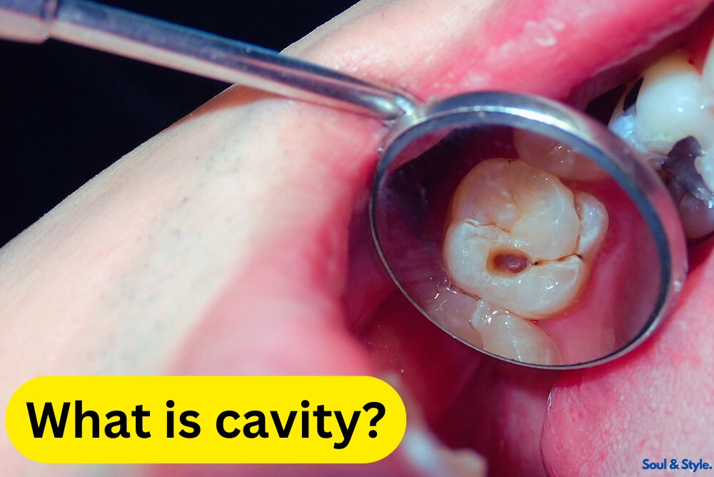 What Does a Cavity Look Like