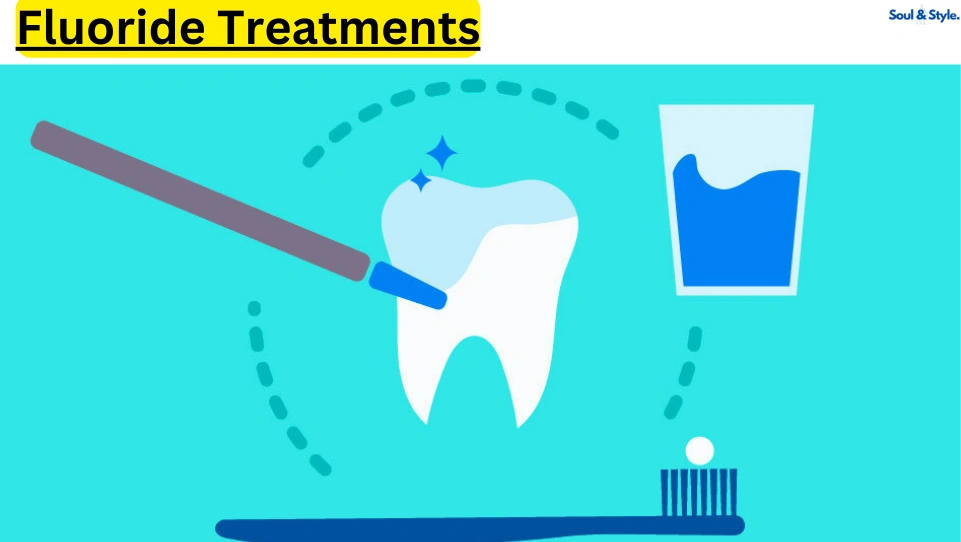 Fluoride Treatments