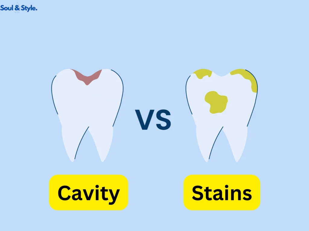 Cavities vs. Stains